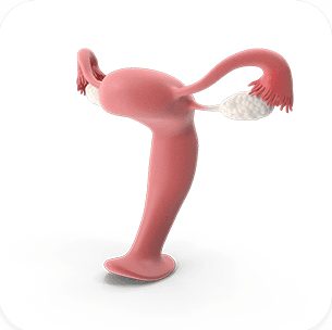 Infertility
